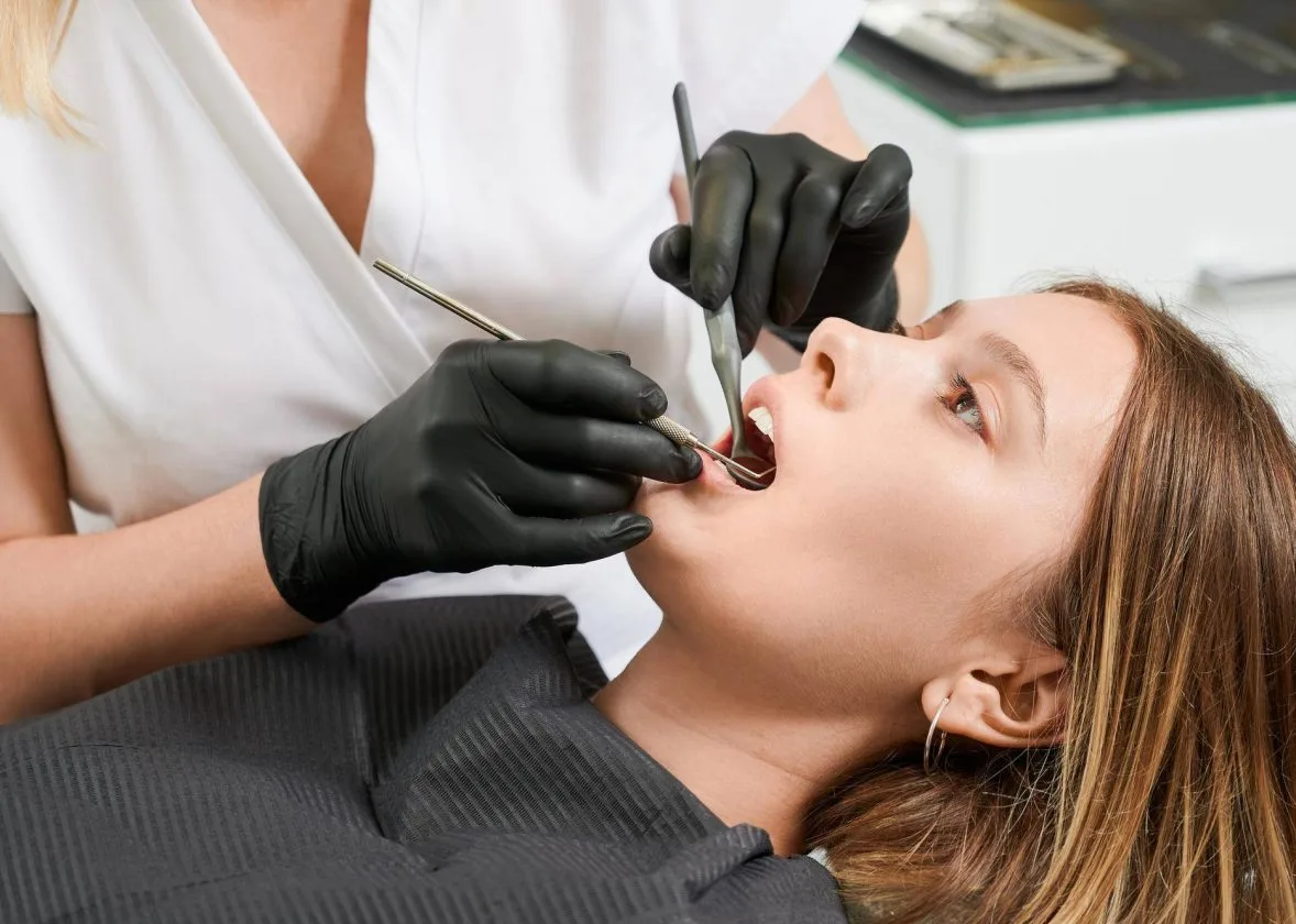 Abcesul dentar – cauze și tratament pentru infecția la măsea