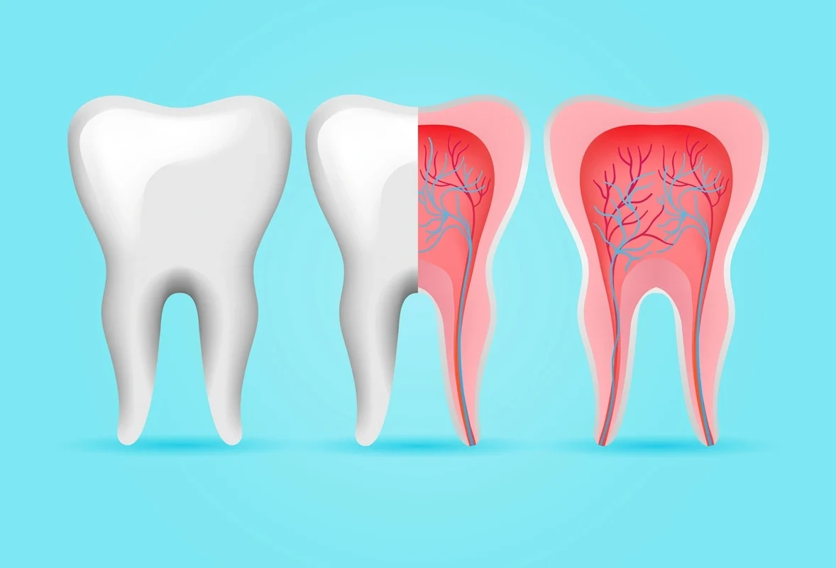 Nervul măselei (dentar) – importanță, tratament și extracție
