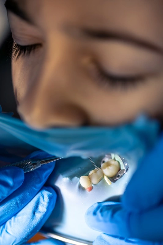 clinica medical hub bucuresti gingivectomie