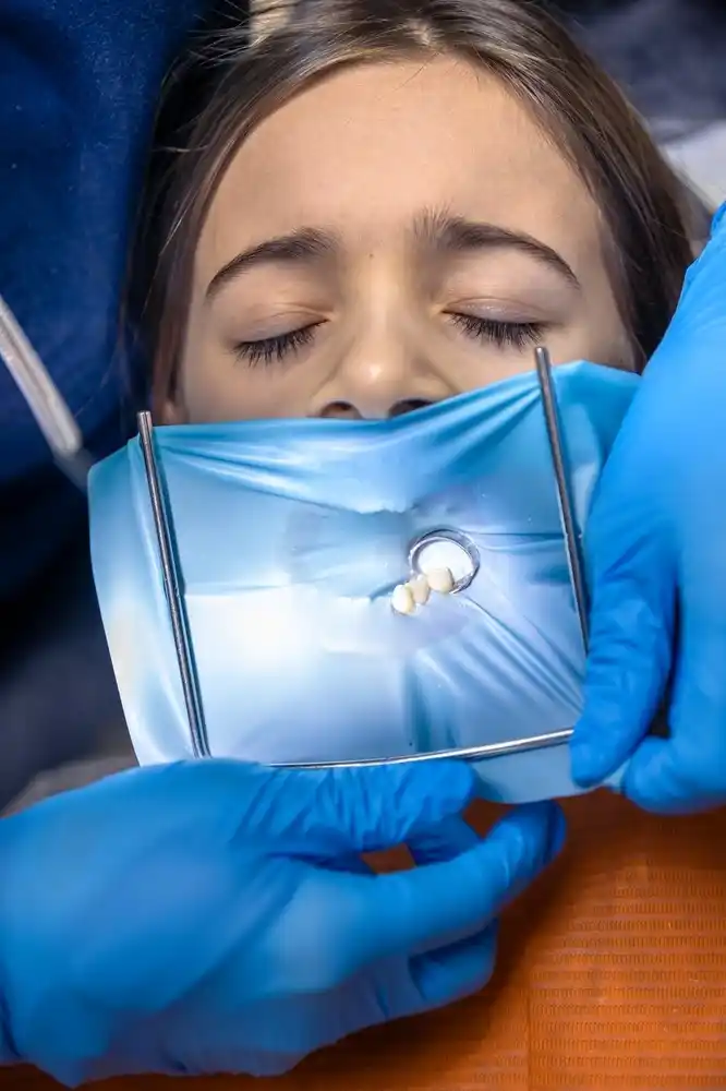 etape chiuretaj dentar clinica medical hub chiuretaj dentar